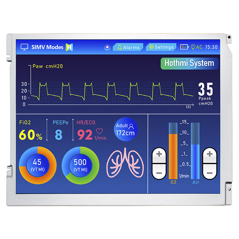 Key Features of the 12.1 Inch TFT LCD Display